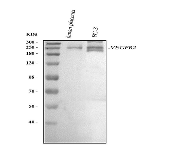 VEGF Receptor 2/KDR Antibody