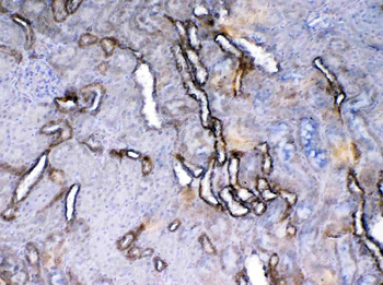 VEGF Receptor 2/Kdr Antibody