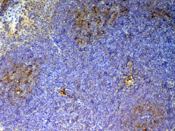 CD59/Cd59a Rabbit Polyclonal Antibody