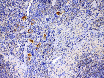 IL12A Rabbit Polyclonal Antibody