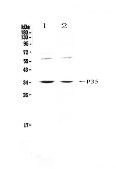 IL12A Rabbit Polyclonal Antibody