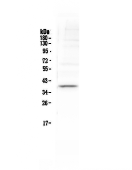 Tal1 Rabbit Polyclonal Antibody