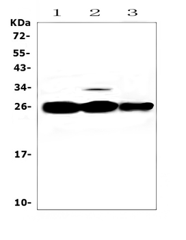MBL2 Rabbit Polyclonal Antibody
