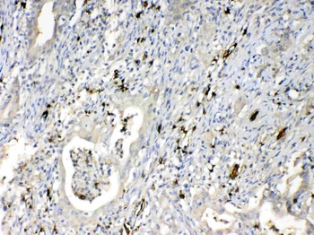 HBD Rabbit Polyclonal Antibody