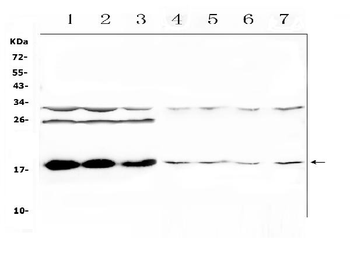 TSLP Rabbit Polyclonal Antibody
