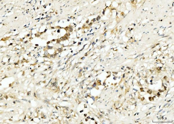 PDCD4 Rabbit Polyclonal Antibody