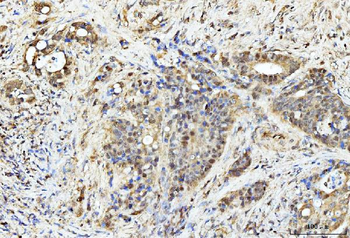 PDCD4 Rabbit Polyclonal Antibody