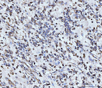 PDCD4 Rabbit Polyclonal Antibody