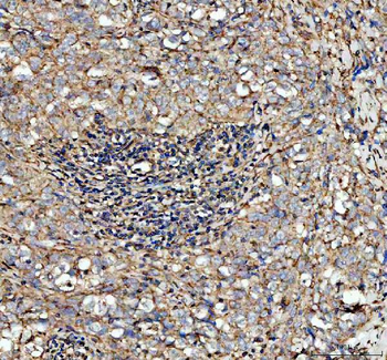 Factor D/CFD Rabbit Polyclonal Antibody