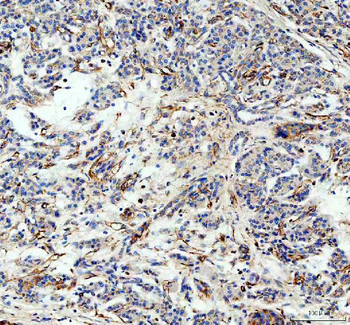 Factor D/CFD Rabbit Polyclonal Antibody