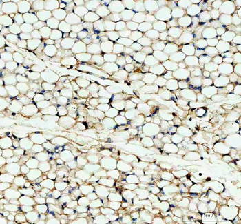 Factor D/CFD Rabbit Polyclonal Antibody