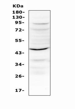 IL12B Rabbit Polyclonal Antibody