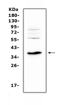 IL12B Antibody