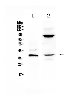 IL12B Rabbit Polyclonal Antibody