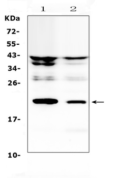 IL11 Rabbit Polyclonal Antibody