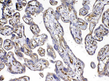 VEGF Receptor 3/FLT4 Antibody