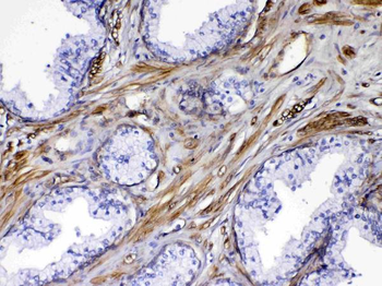 VEGF Receptor 3/FLT4 Antibody