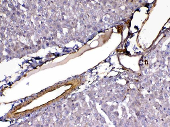 VEGF Receptor 3/FLT4 Antibody
