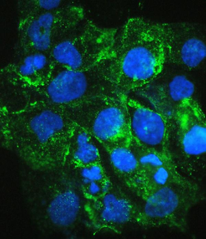 VEGF Receptor 3/FLT4 Antibody