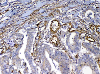 VEGF Receptor 3/FLT4 Antibody