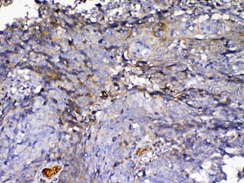 IGFBP2 Rabbit Polyclonal Antibody