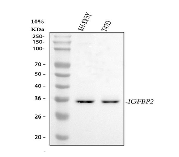 IGFBP2 Rabbit Polyclonal Antibody