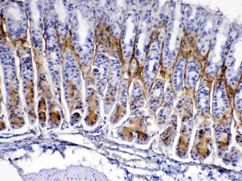 Periostin/Postn Rabbit Polyclonal Antibody