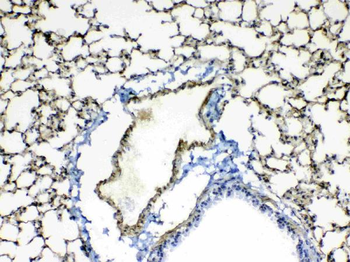 Periostin/Postn Rabbit Polyclonal Antibody