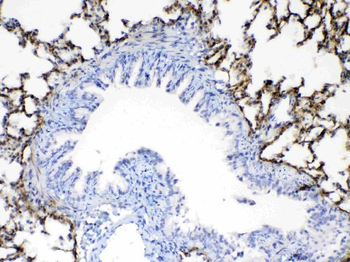 Periostin/Postn Rabbit Polyclonal Antibody