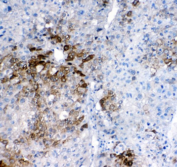 GSTA1/A2/A3/A4/A5 Rabbit Polyclonal Antibody