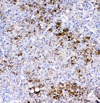 GSTA1/A2/A3/A4/A5 Rabbit Polyclonal Antibody