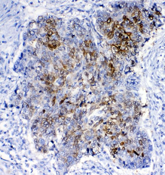 GSTA1/A2/A3/A4/A5 Rabbit Polyclonal Antibody