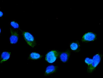 GRK2/GRK2 Rabbit Polyclonal Antibody
