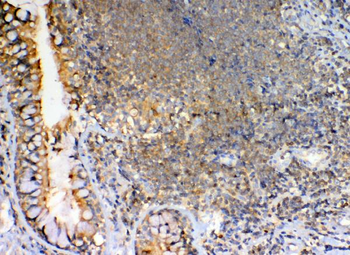 GRK2/GRK2 Rabbit Polyclonal Antibody