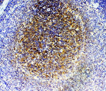 GRK2/GRK2 Rabbit Polyclonal Antibody