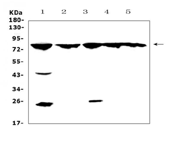 GRK2/GRK2 Rabbit Polyclonal Antibody