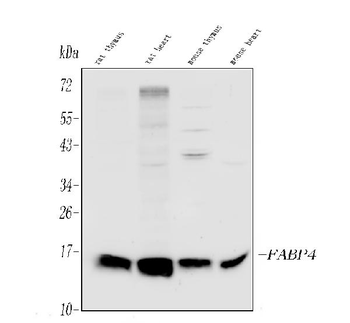 FABP4 Rabbit Polyclonal Antibody