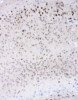 IL-16/Il16/IL Rabbit Polyclonal Antibody