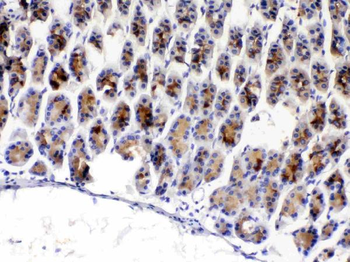 TFF3 Rabbit Polyclonal Antibody