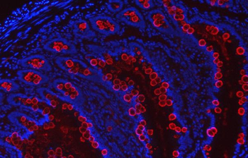 TFF3 Rabbit Polyclonal Antibody