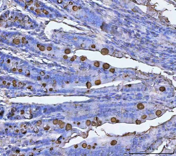 TFF3 Rabbit Polyclonal Antibody