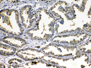 Superoxide Dismutase 3/SOD3 Rabbit Polyclonal Antibody