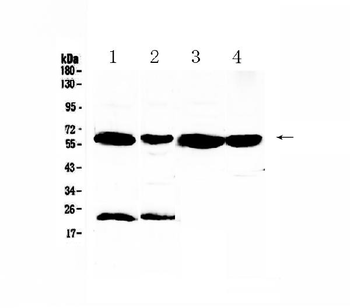 UGT1A1 Rabbit Polyclonal Antibody