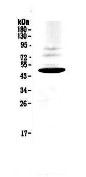CCR1 Rabbit Polyclonal Antibody