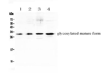 IL17F Rabbit Polyclonal Antibody