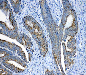 FH Rabbit Polyclonal Antibody