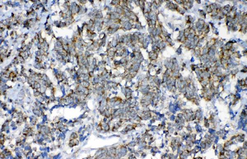 FH Rabbit Polyclonal Antibody