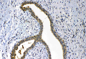 FH Rabbit Polyclonal Antibody