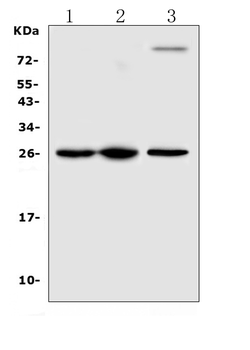 TREM1 Rabbit Polyclonal Antibody