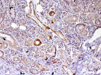 Frizzled 4/FZD4 Antibody
